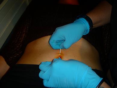 les 8 étapes du piercing au nombril